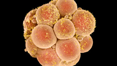 First Successful DNA Editing Intervention Just Happened in China 3 p6800390 coloured sem of human embryo at 16 cell stage spl 1200x800