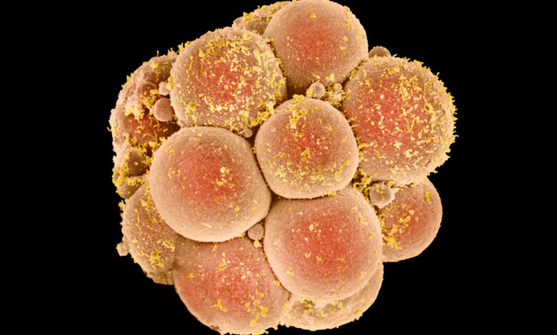 p6800390 coloured sem of human embryo at 16 cell stage spl 1200x800