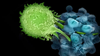 New Hope for Aggressive Type of Breast Cancer: Immunotherapy Success 1 1498173526391